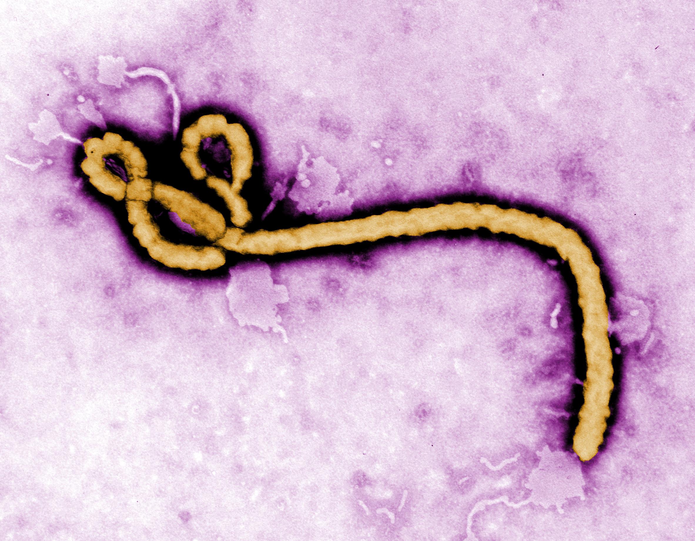 Rubio thanks Czech PM for taking in American Ebola evacuee, WHO declares international emergency